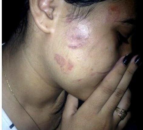 Grávida é espancada pelo marido após o flagrar com duas mulheres em casa