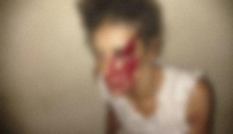 Jovem é agredida ao sair para fazer programa