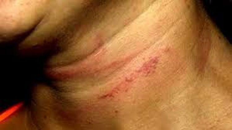 Homem mata cachorro e coloca fogo nas roupas de ex