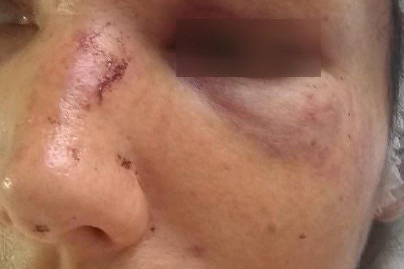 Mulher flagra mensagens de outra e acaba espancada