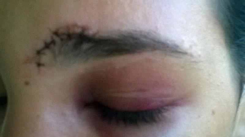 Bebê é agredido por padrasto, mãe vai defender e acaba levando socos no rosto