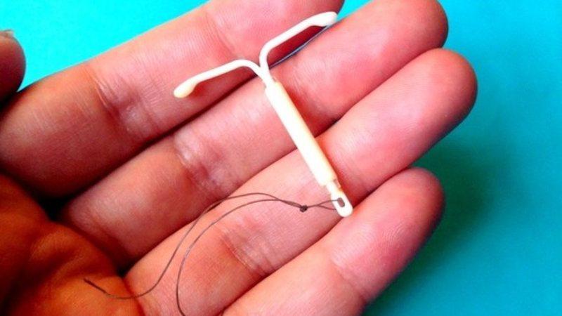 Marido tem que autorizar? Saiba como funciona colocação de DIU pelo SUS em MS